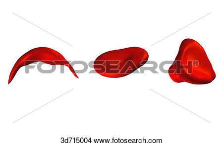 Drawing   Red Blood Cells Of Irregular Shape  Drepanocyte  Sickle Cell