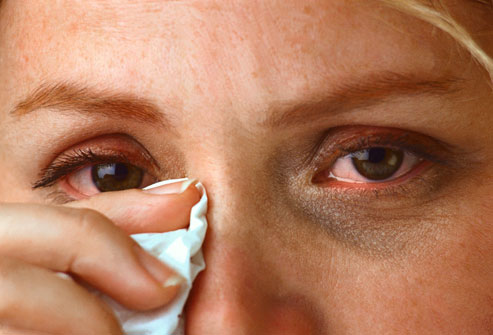 Eyelids   Causes Symptoms Treatment Swollen   Diseases Pictures